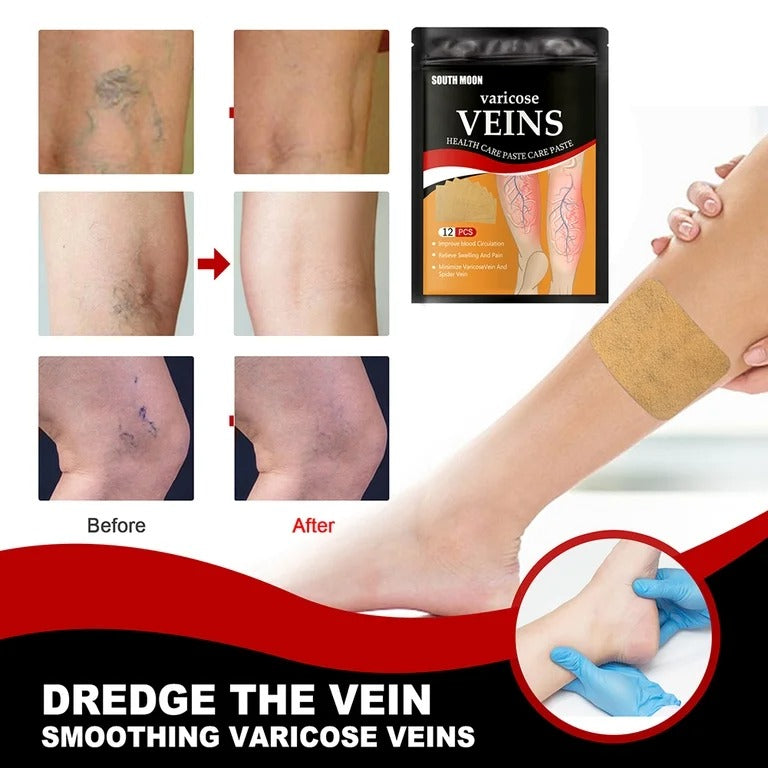 12 PARCHES PARA VENAS VARICES