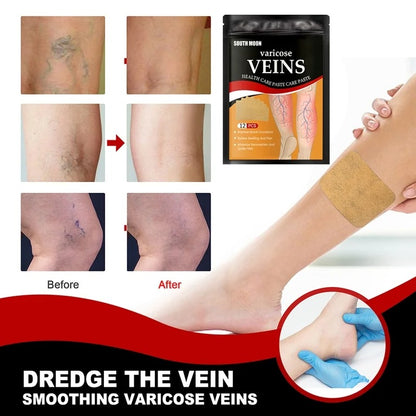 12 PARCHES PARA VENAS VARICES
